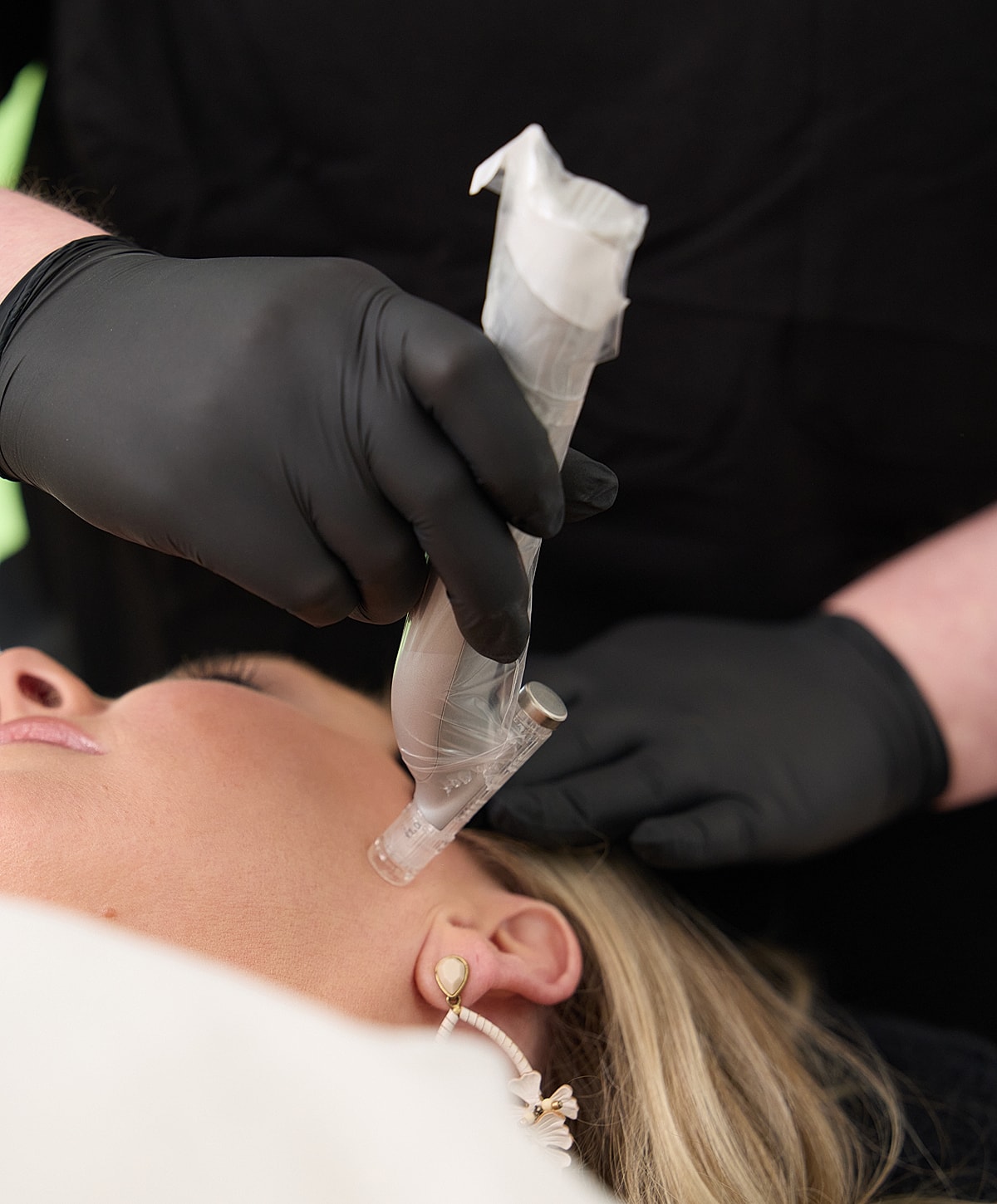 Skin treatment procedure in progress with device.