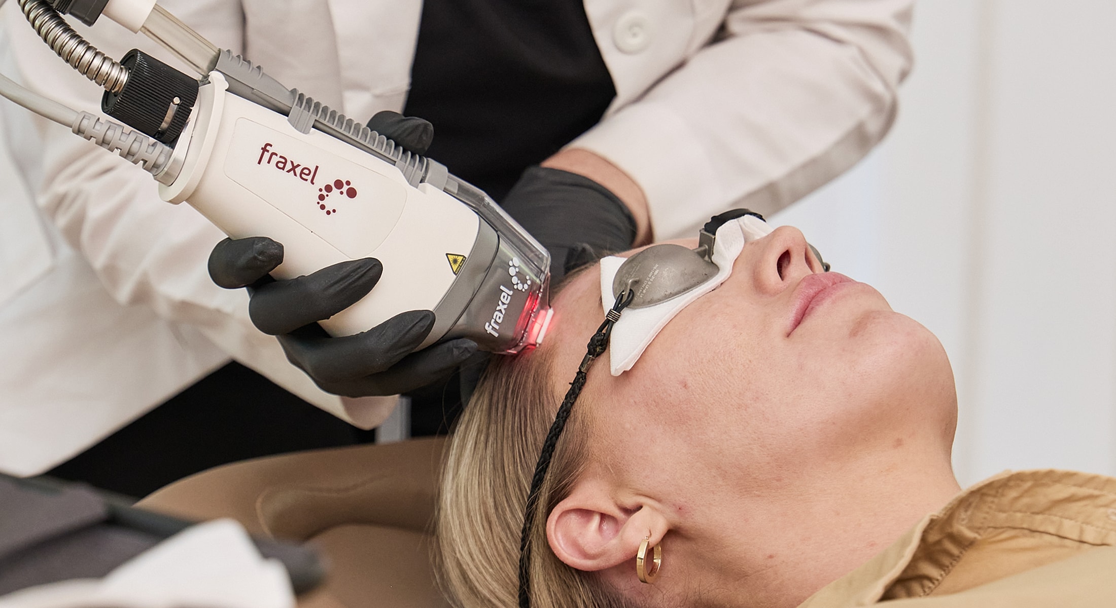 Patient receiving Fraxel laser treatment for skin rejuvenation.