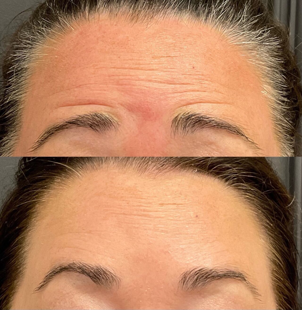 Botox | Marvel Cosmetic Medspa + Surgery